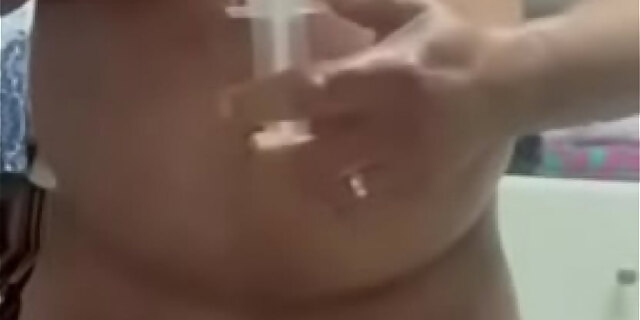 anal,ass